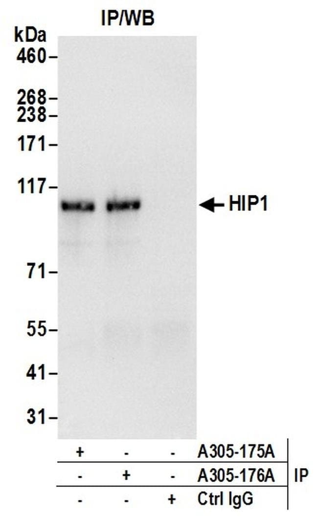 HIP1/Huntingtin-interacting Protein 1 Rabbit anti-Human, Polyclonal, Bethyl Laboratories